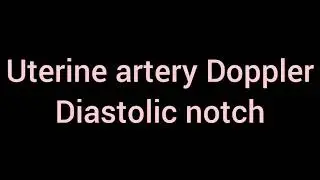 Uterine artery Doppler- Dr.Arul's USG Tips