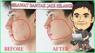 100% BERHASIL! Cara Menghilangkan Jerawat Banyak di Photoshop CS6 - Tutorial Edit Foto Sederhana