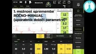 Ventilator Elisa: preklop na 