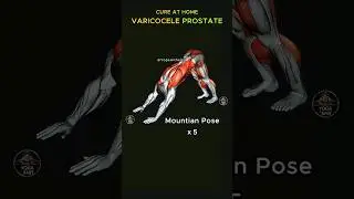 Cure Varicocele & Prostate at Home #varicocele #prostate #hydrocele #menshealth