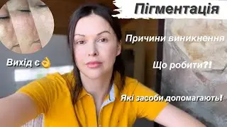 🔖Пігментація/ Причини виникнення/ Що робити/ Які засоби обрати 🔖