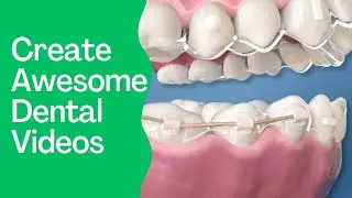 Create your own Dental Video!