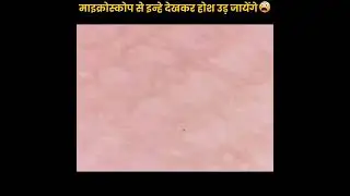 माइक्रोस्कोप मे ये दिखा होश उड़ जायेंगे #शॉर्ट्सवीडियो #Shorts