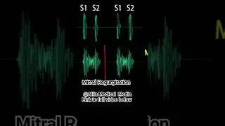 Heart Murmurs: Mitral Valve Regurgitation #heartmurmurs  #medicalanimation