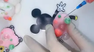 Decompression toys, immersive acne popping, sleep aid ASMR#PIMPLE POPPINGs #stress relief toys