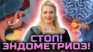 Эндометриоз! Истинные причины болезни могут вас удивить!