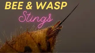 What Everyone Should Know About Bee & Wasp Stings 🐝🐝🐝