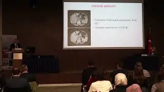 Prof  Dr  Erman Çakal ile İnsidental Sürrenal Kitlelere Vakalarla Yaklaşım