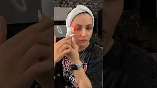 Лицо без уколов☑️Микротоковый массажер для лицаWB арт 173132826
