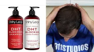 Should You Buy ShinyLeaf DHT Blocking Shampoo?