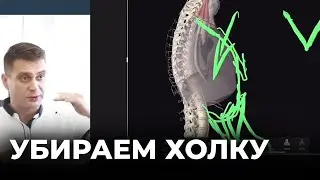 ПОКАЗЫВАЮ КАК УБРАТЬ ХОЛКУ ЗА 12 ШАГОВ. МАСТЕР-КЛАСС ПРИЧИНЫ ПЛОХОЙ ОСАНКИ