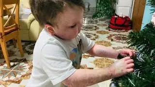 Реабилитация в домашних условиях | Маркуша и ёлочка | На гормонах | Лечение РТПХ после ТКМ