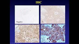Pathoradiological corr cases (Breast) – Surgical Pathology and Cytology