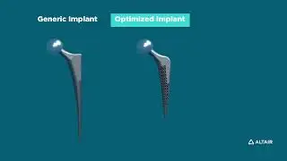 Developing a 3D Printed Solid Lattice Hip Prosthesis