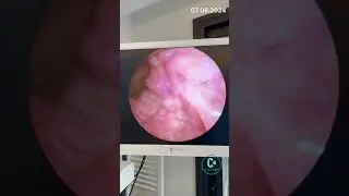 Persistent bad breath.