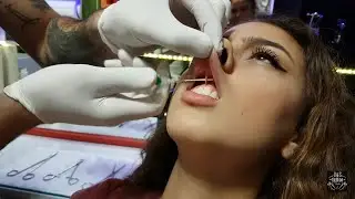 Painless Smiley Piercing