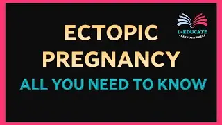 ECTOPIC PREGNANCY (PREGNANCY OUTSIDE THE WOMB) - All You Need To Know