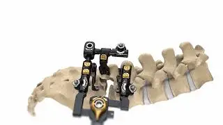 Modulus TLIF O - Product Animation