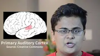 The American Crowbar Case: How a Metal Rod Shaped Modern Neuroscience