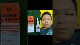 kumpulan foto kocak