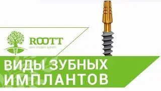 Зубной имплантат установка. 🔬 Особенности установки компрессионных зубных имплантатов.