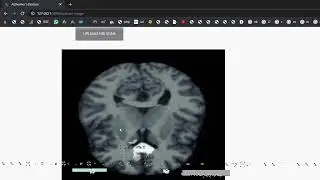 Volumetric Segmentation of Brain Regions From MRI Scans Using 3D Convolutional Neural Networks