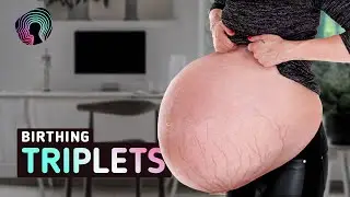 Giving Birth to Triplets