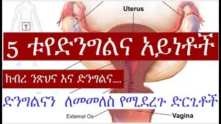 አምስቱ የክብረ ንጽህና አይነቶች   || የድንግልና እና የክብረ ንጽህና አንድነትና ልዩነት || ዶ.ር ፍቅር…
