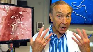 WORMS In The Mouth! Rare Infestation In The Tongue and Gums 🪱