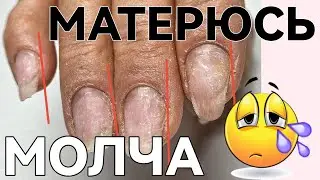 СЛОЖНАЯ КОРРЕКЦИЯ / спиленные боковые стенки / клюющие ногти / маникюр от другого мастера до и после