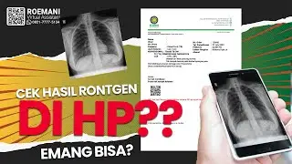 TUTORIAL CEK FOTO RONTGEN DI HP