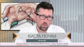 КИСТА ПОЧКИ - лечение
