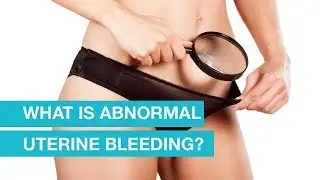 What is abnormal uterine bleeding?