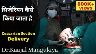 How is Cessarian Section | Cessarian Delivery me kya hota hai? | Dr.Kaajal Mangukiya