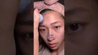 Microderm Elite Pro!