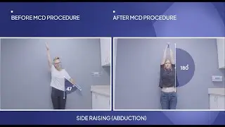 Best Frozen Shoulder Treatment! See Most Effective Treatment for Frozen Shoulder Pain & Immobility!