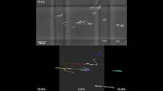 Cancer cells migrating toward a 