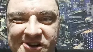 Стрим. Йодопрофилактика.