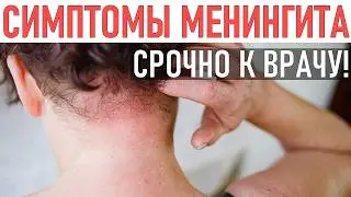 СИМПТОМЫ МЕНИНГИТА. Ранние признаки менингококковой инфекции