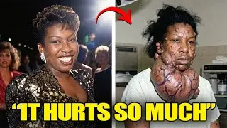 27 Black Celebrities Who Died From Incurable Diseases