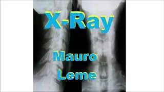 X-Ray - SLBLOCK - Mauro Leme