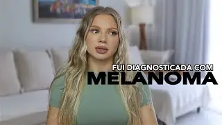 Fui diagnosticada com MELANOMA