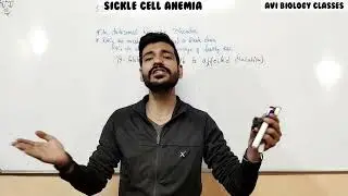 SICKLE CELL ANEMIA