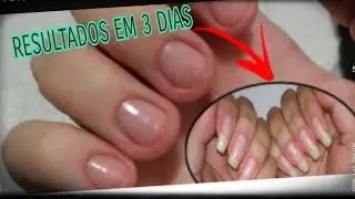 UNHAS GRANDES EM 3 DIAS
