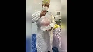 Унг тухумдон кистоз хосиласи.
