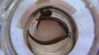 Эти пиявки уже свое откусали