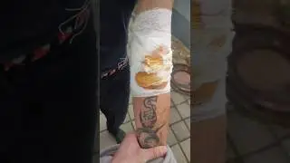 Солевые последствия 💉 