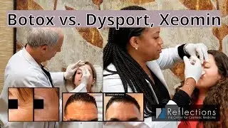 Botox vs. Dysport, Xeomin, MyoBloc [Which One is Right for You?]