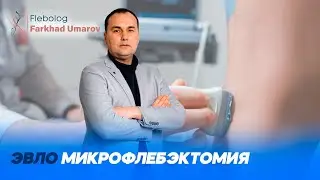 ЭВЛО микрофлебэктомия