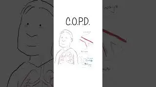 COPD - Explained #healthsketch #shorts